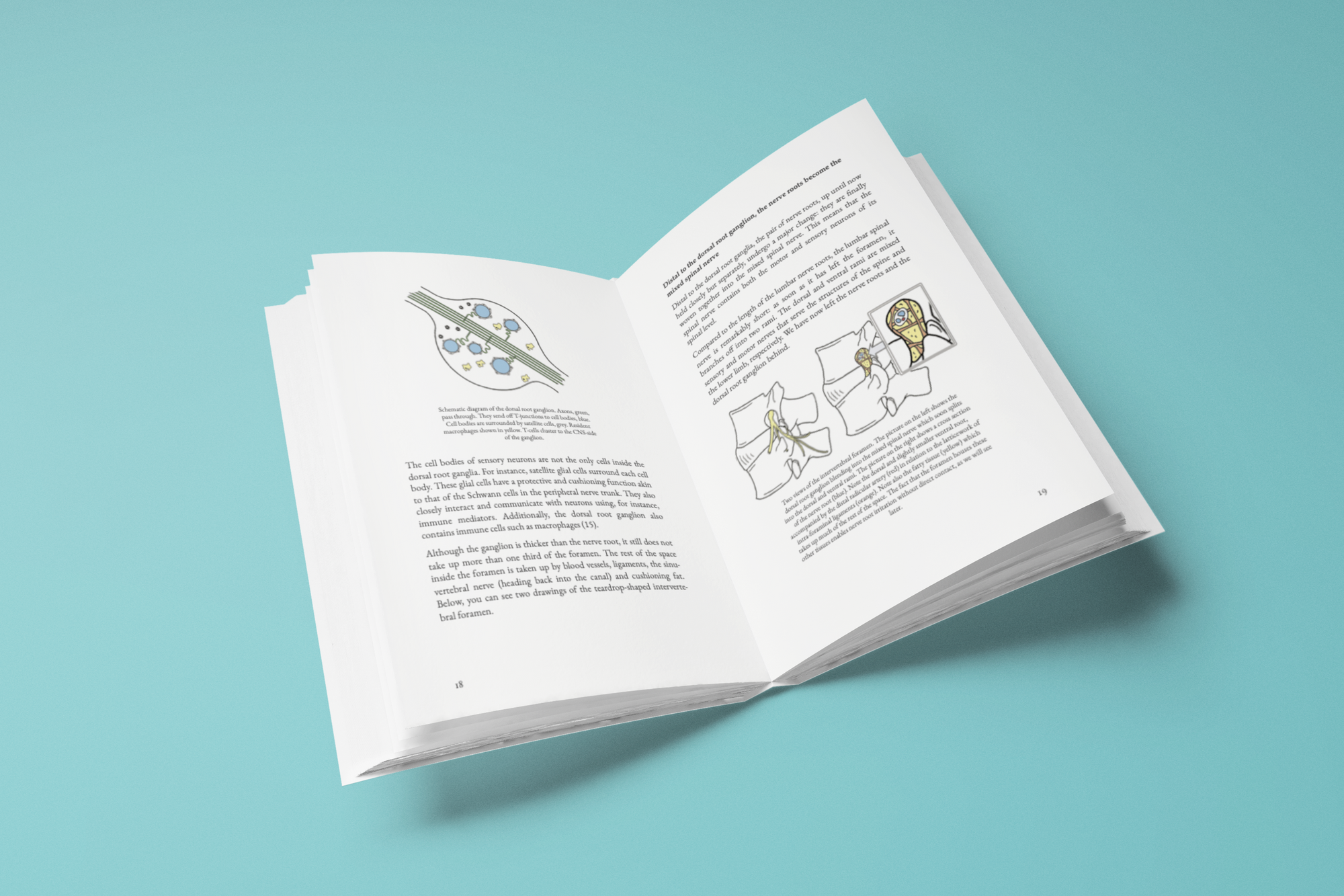 Understanding Sciatica