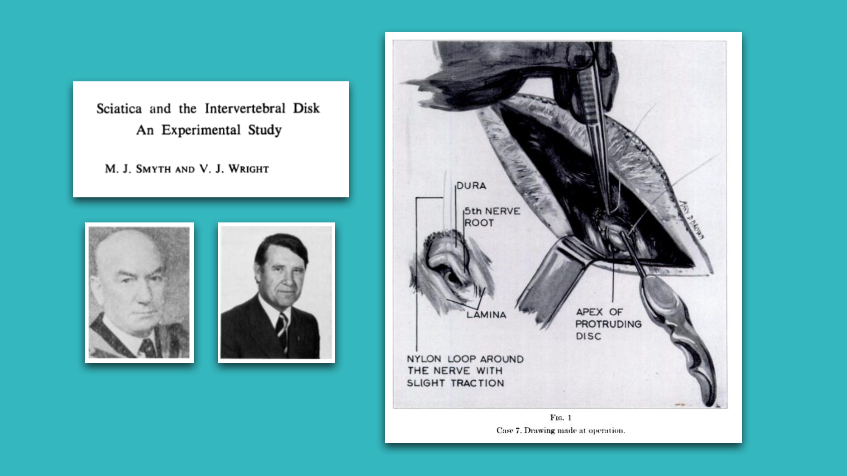Lecture: Assessment of Sciatica